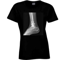 Load image into Gallery viewer, Point Guard Ankle Taker Breaker X Ray Basketball Kyrie Irving Fan T Shirt - image_ebcaa4a3-a281-4bc6-b791-a2369fc036bc